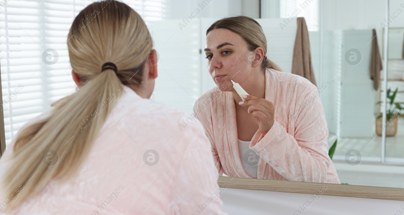 Woman applying cream onto face near mirror indoors. Acne treatment Photo of Woman applying cream onto face near mirror indoors. Acne treatment