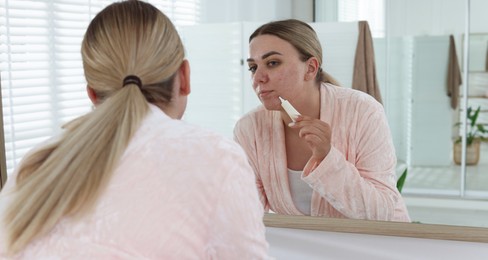 Photo of Woman applying cream onto face near mirror indoors. Acne treatment