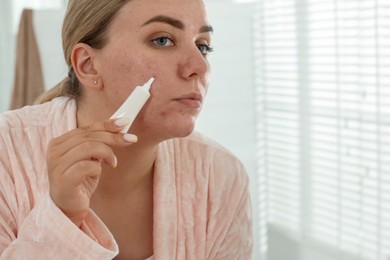 Photo of Woman applying cream onto face indoors, space for text. Acne treatment