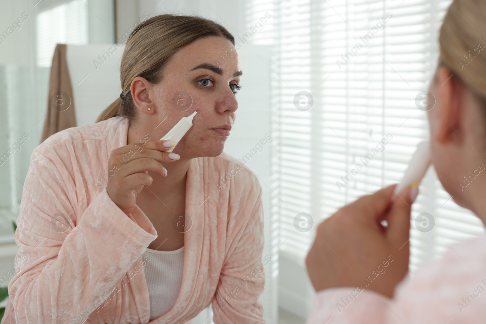 Woman applying cream onto face near mirror indoors. Acne treatment Photo of Woman applying cream onto face near mirror indoors. Acne treatment