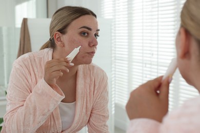 Photo of Woman applying cream onto face near mirror indoors. Acne treatment