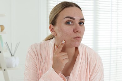 Photo of Beautiful woman with acne problem in bathroom