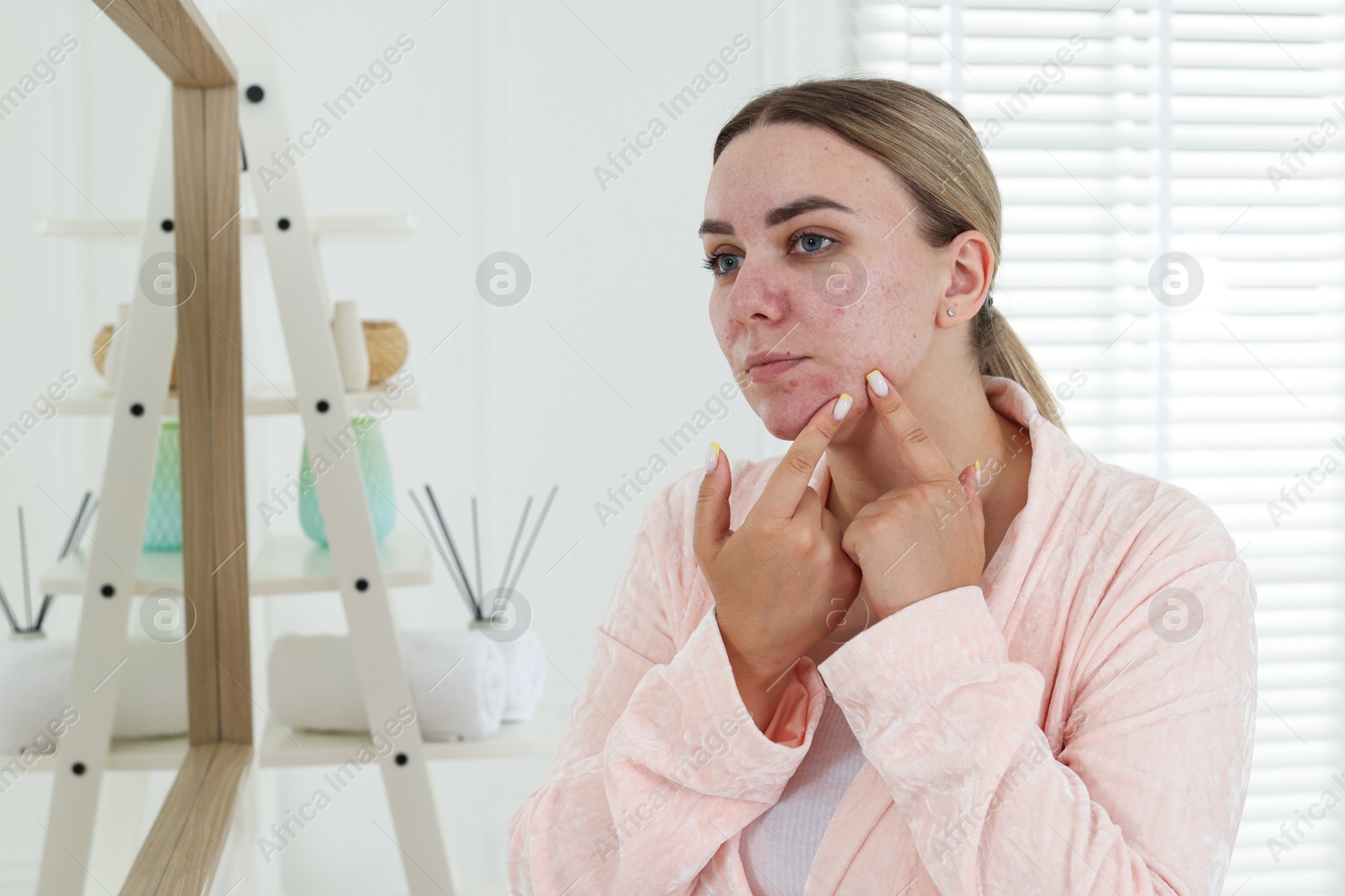 Woman popping pimple near mirror in bathroom. Acne problem Photo of Woman popping pimple near mirror in bathroom. Acne problem