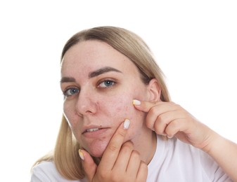 Photo of Woman with acne problem on white background