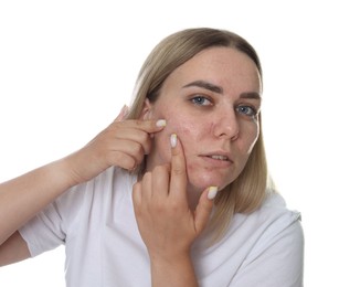 Photo of Woman with acne problem on white background