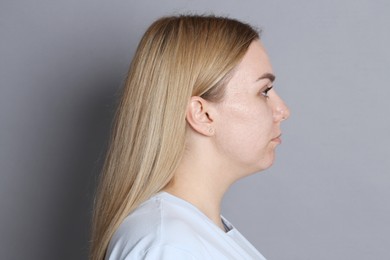 Photo of Beautiful woman with acne problem on grey background