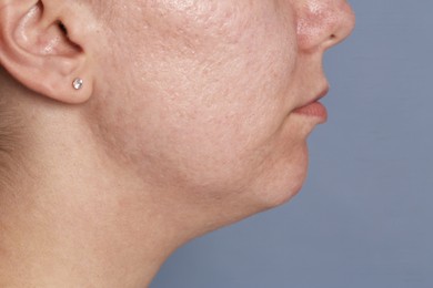 Photo of Closeup view of woman on grey background