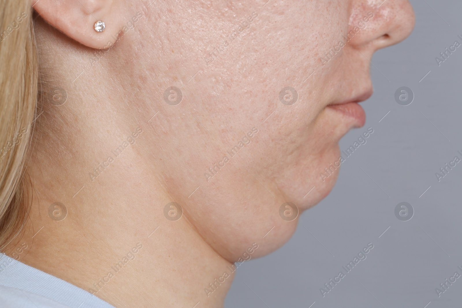 Woman with double chin on grey background, closeup Photo of Woman with double chin on grey background, closeup