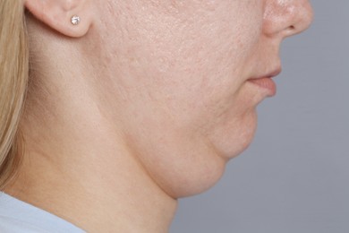 Photo of Woman with double chin on grey background, closeup