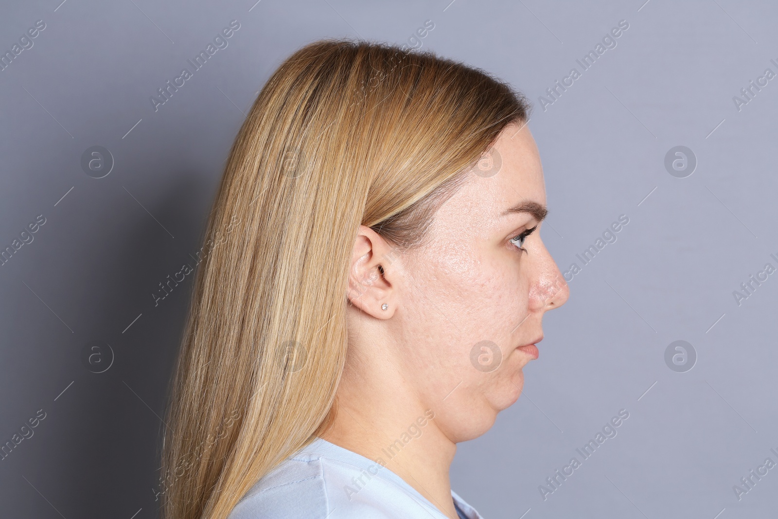 Woman with double chin on grey background Photo of Woman with double chin on grey background