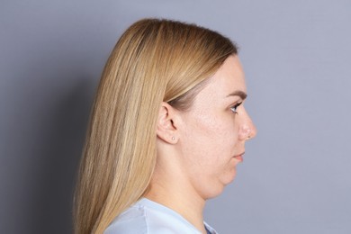 Photo of Woman with double chin on grey background