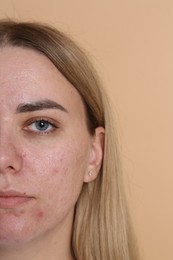 Photo of Closeup view of woman on beige background