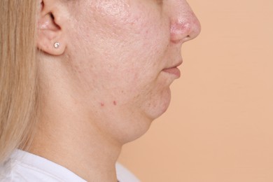 Photo of Woman with double chin on beige background, closeup. Space for text