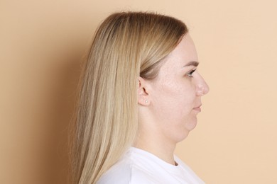 Photo of Woman with double chin on beige background