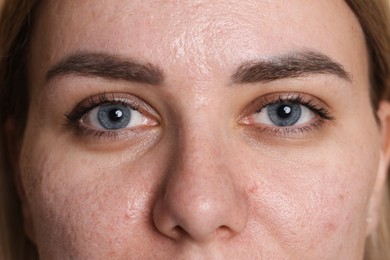 Photo of Closeup view of woman with beautiful eyes