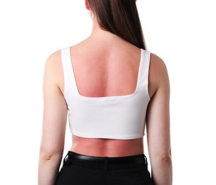 Photo of Woman with sunburned skin on white background, back view