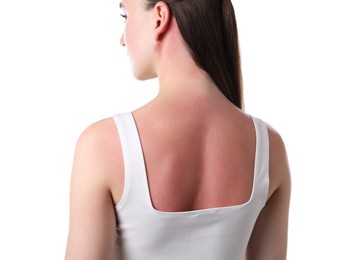 Photo of Woman with sunburned skin on white background