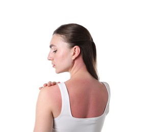 Photo of Woman with sunburned skin on white background
