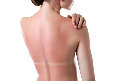 Photo of Woman with sunburned skin on white background, back view