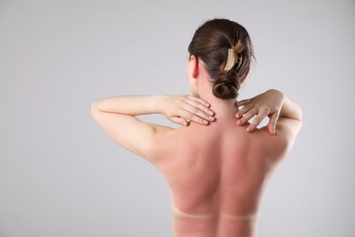 Photo of Woman with sunburned skin on grey background, back view. Space for text