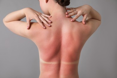 Photo of Woman with sunburned skin on grey background, back view