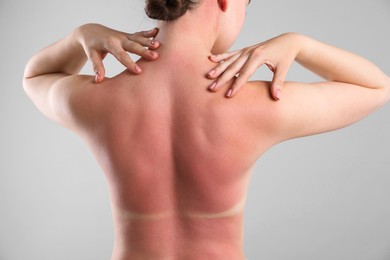 Photo of Woman with sunburned skin on grey background, back view