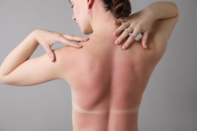 Photo of Woman with sunburned skin on grey background, back view