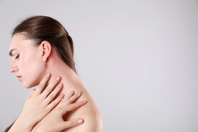 Photo of Woman with sunburned skin on grey background, space for text