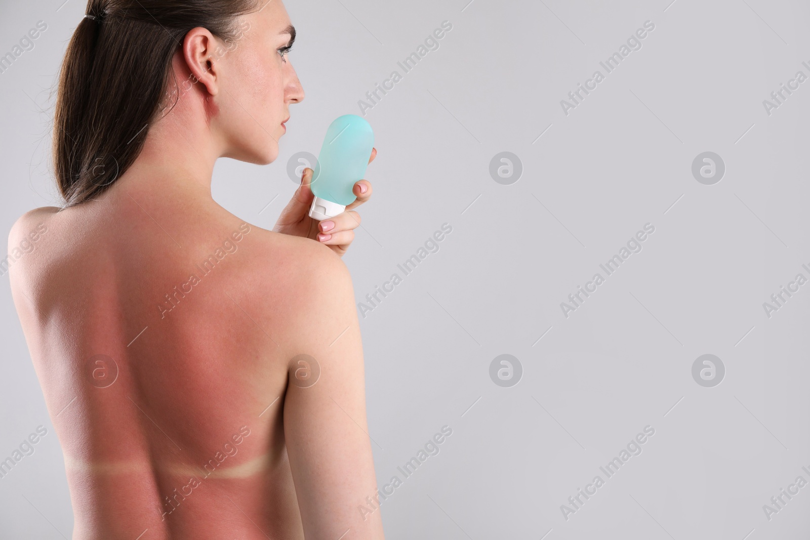 Woman with sunburned skin holding bottle of sun protection product on grey background, back view. Space for text Photo of Woman with sunburned skin holding bottle of sun protection product on grey background, back view. Space for text