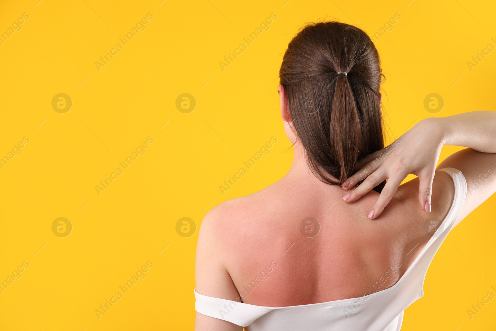 Woman with sunburned skin on orange background, back view. Space for text Photo of Woman with sunburned skin on orange background, back view. Space for text