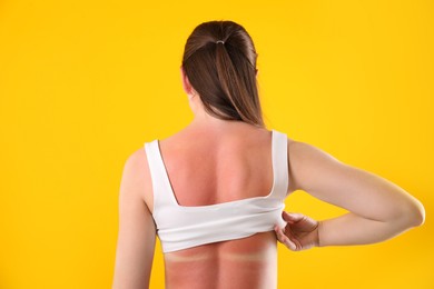 Photo of Woman with sunburned skin on orange background, back view