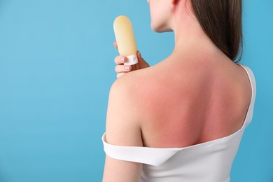 Photo of Woman with sunburned skin holding bottle of sun protection product on light blue background, closeup. Space for text