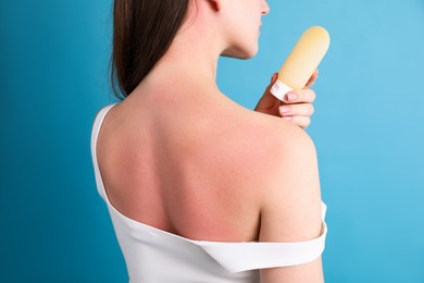 Photo of Woman with sunburned skin holding bottle of sun protection product on light blue background, closeup