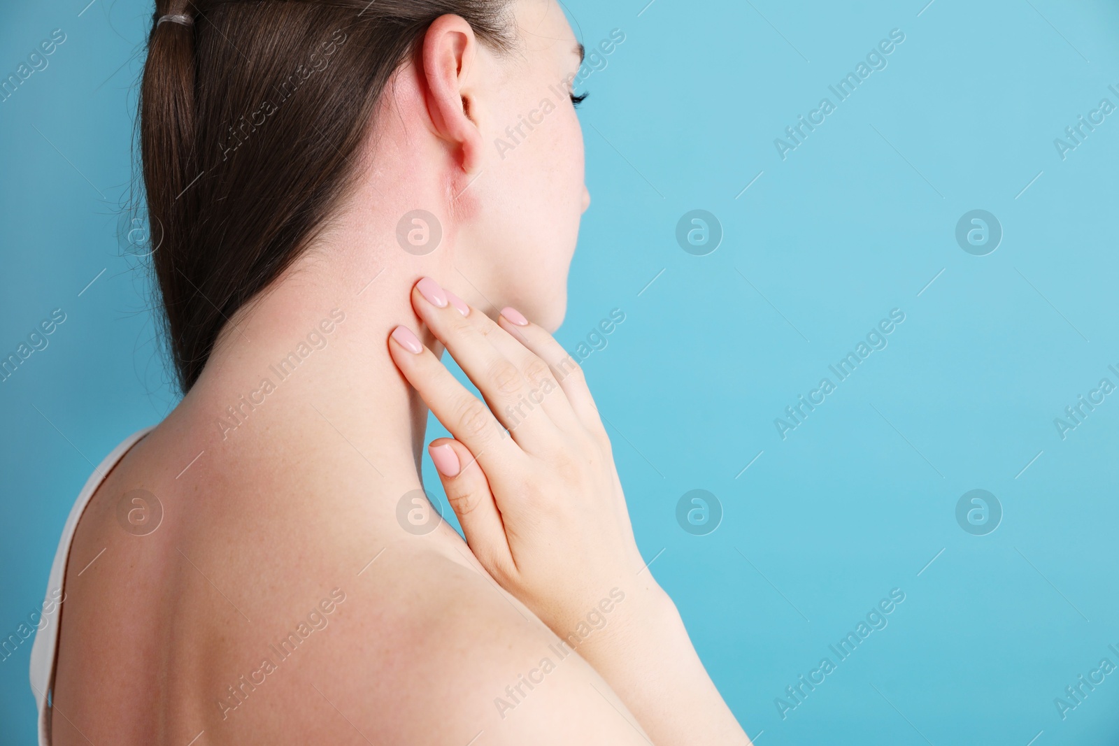 Photo of Woman with sunburned skin on light blue background, closeup. Space for text