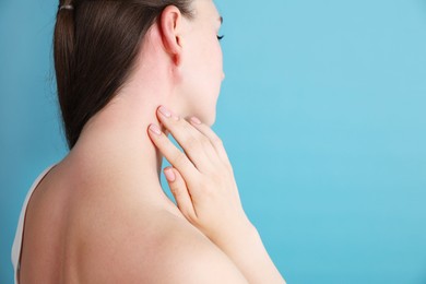 Photo of Woman with sunburned skin on light blue background, closeup. Space for text