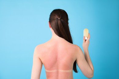 Photo of Woman with sunburned skin holding bottle of sun protection product on light blue background, back view