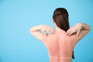 Photo of Woman with sunburned skin on light blue background, back view. Space for text