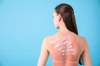 Photo of Woman with sun protection product on her sunburned skin against light blue background, back view. Space for text
