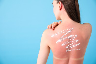 Photo of Woman with sun protection product on her sunburned skin against light blue background, back view. Space for text