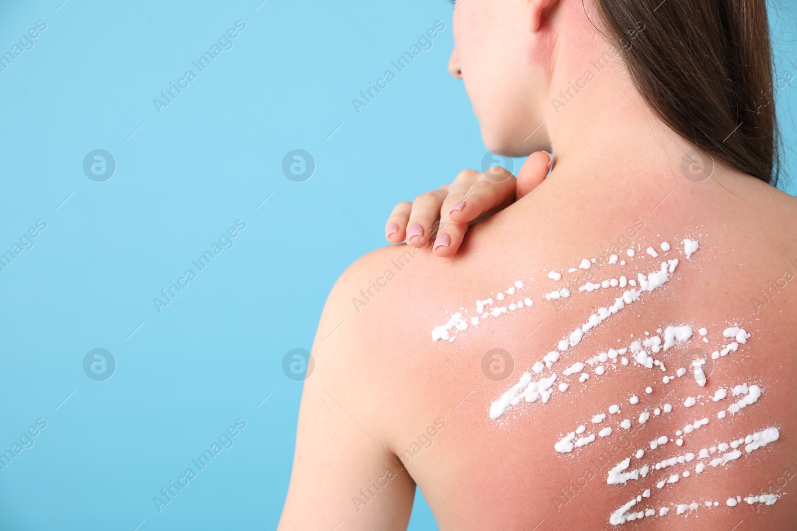 Woman with sun protection product on her sunburned skin against light blue background, back view. Space for text Photo of Woman with sun protection product on her sunburned skin against light blue background, back view. Space for text