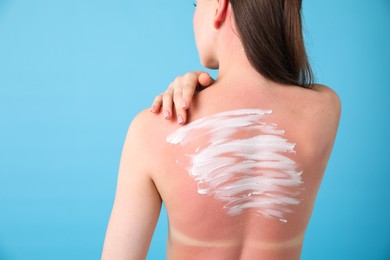 Photo of Woman with sun protection product on her sunburned skin against light blue background, back view. Space for text