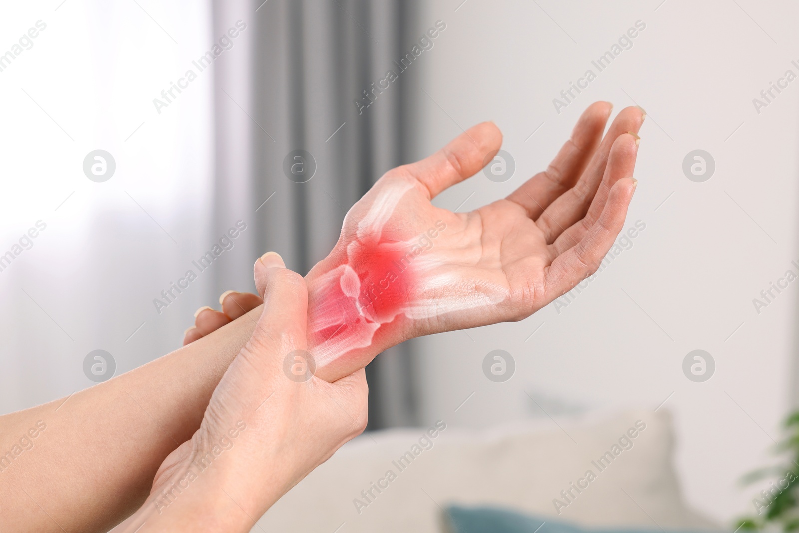 Arthritis. Woman suffering from wrist pain indoors, closeup. Illustration of joint inflammation on her hand Image of Arthritis. Woman suffering from wrist pain indoors, closeup. Illustration of joint inflammation on her hand