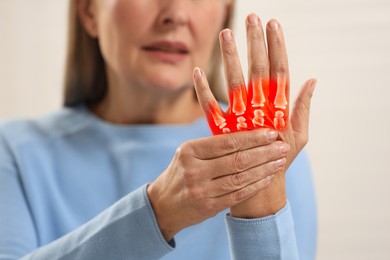 Image of Arthritis. Senior woman suffering from pain in hand against light background, closeup. Illustration of joint inflammation