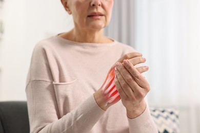 Image of Arthritis. Senior woman suffering from pain in hand indoors, closeup. Illustration of joint inflammation
