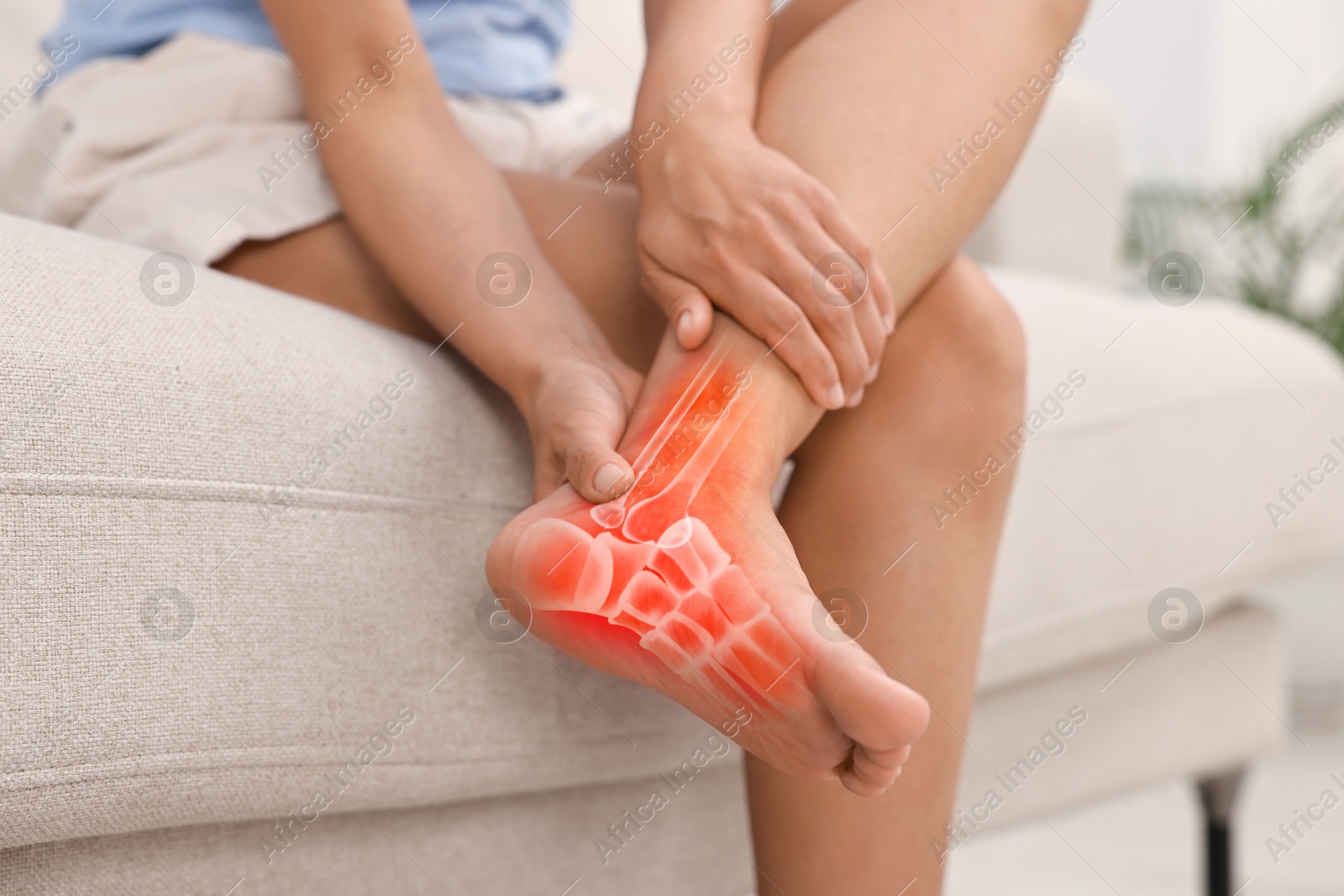 Image of Arthritis symptom. Woman suffering from foot pain indoors, closeup. Illustration of joint inflammation on her leg