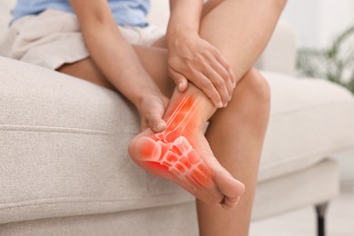 Image of Arthritis symptom. Woman suffering from foot pain indoors, closeup. Illustration of joint inflammation on her leg