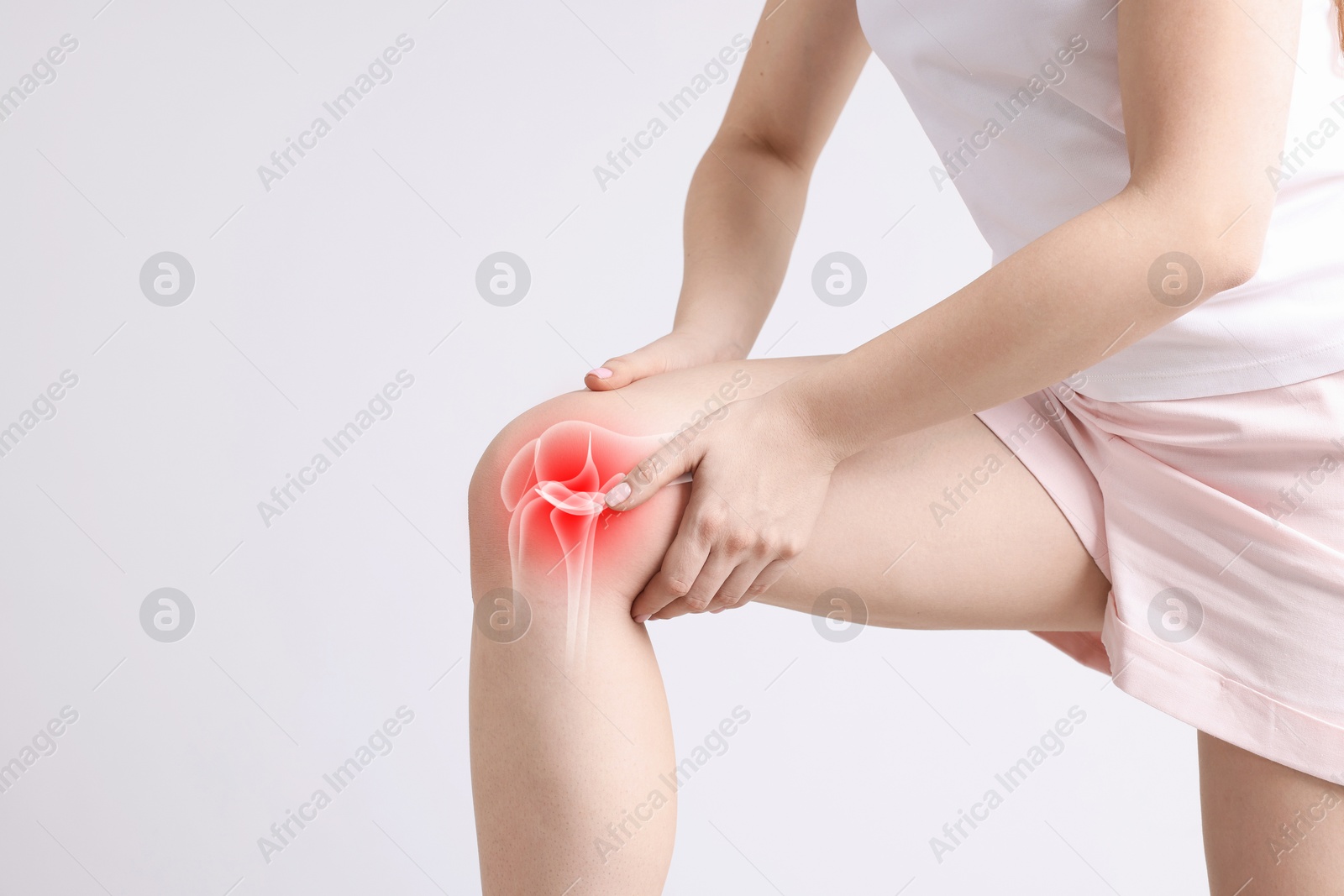 Arthritis. Woman suffering from pain in knee on light background, closeup. Illustration of joint inflammation on her leg Image of Arthritis. Woman suffering from pain in knee on light background, closeup. Illustration of joint inflammation on her leg