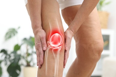 Image of Arthritis. Senior woman suffering from pain in her knee indoors, closeup. Illustration of joint inflammation on his leg