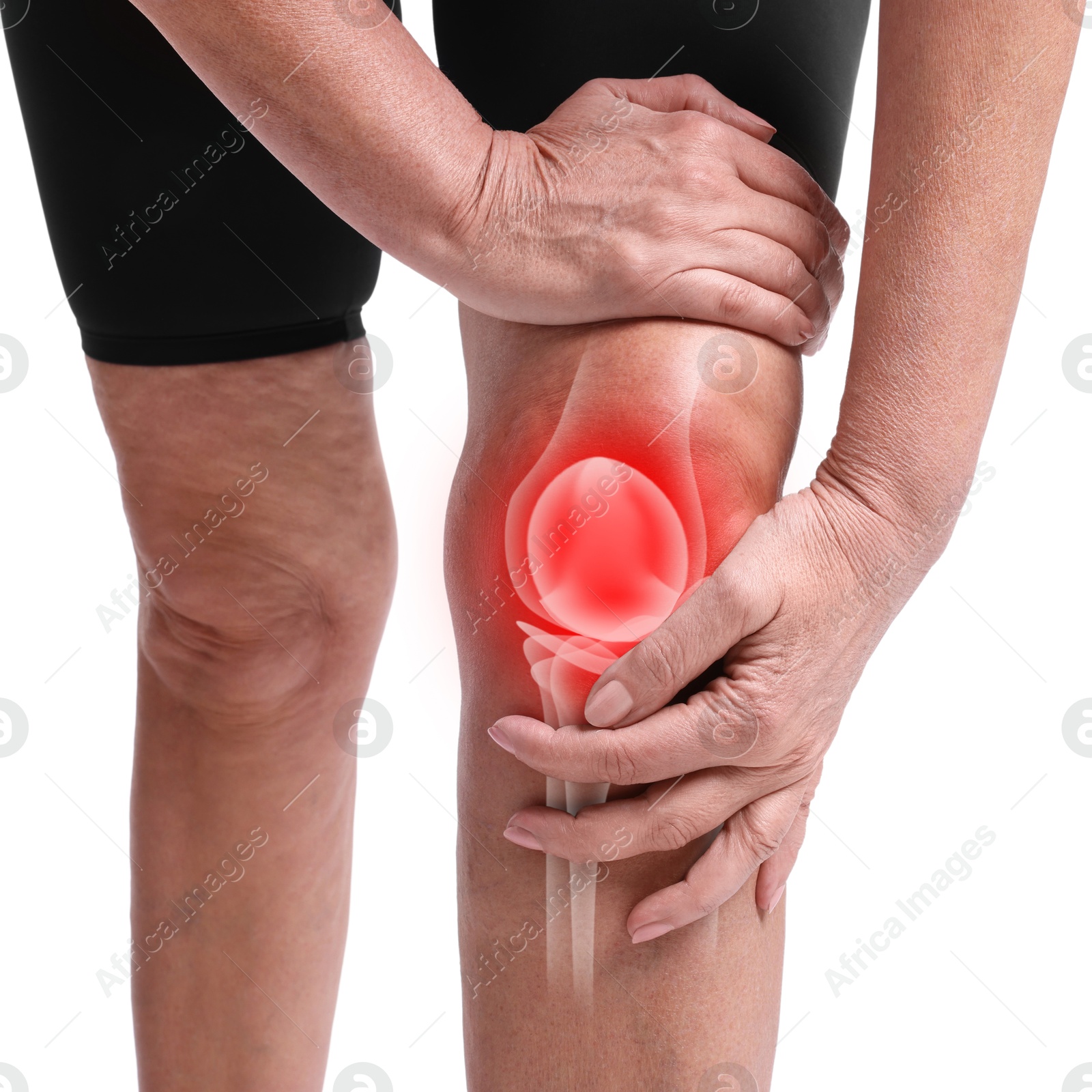 Image of Arthritis. Senior woman suffering from pain in her knee on white background, closeup. Illustration of joint inflammation on her leg