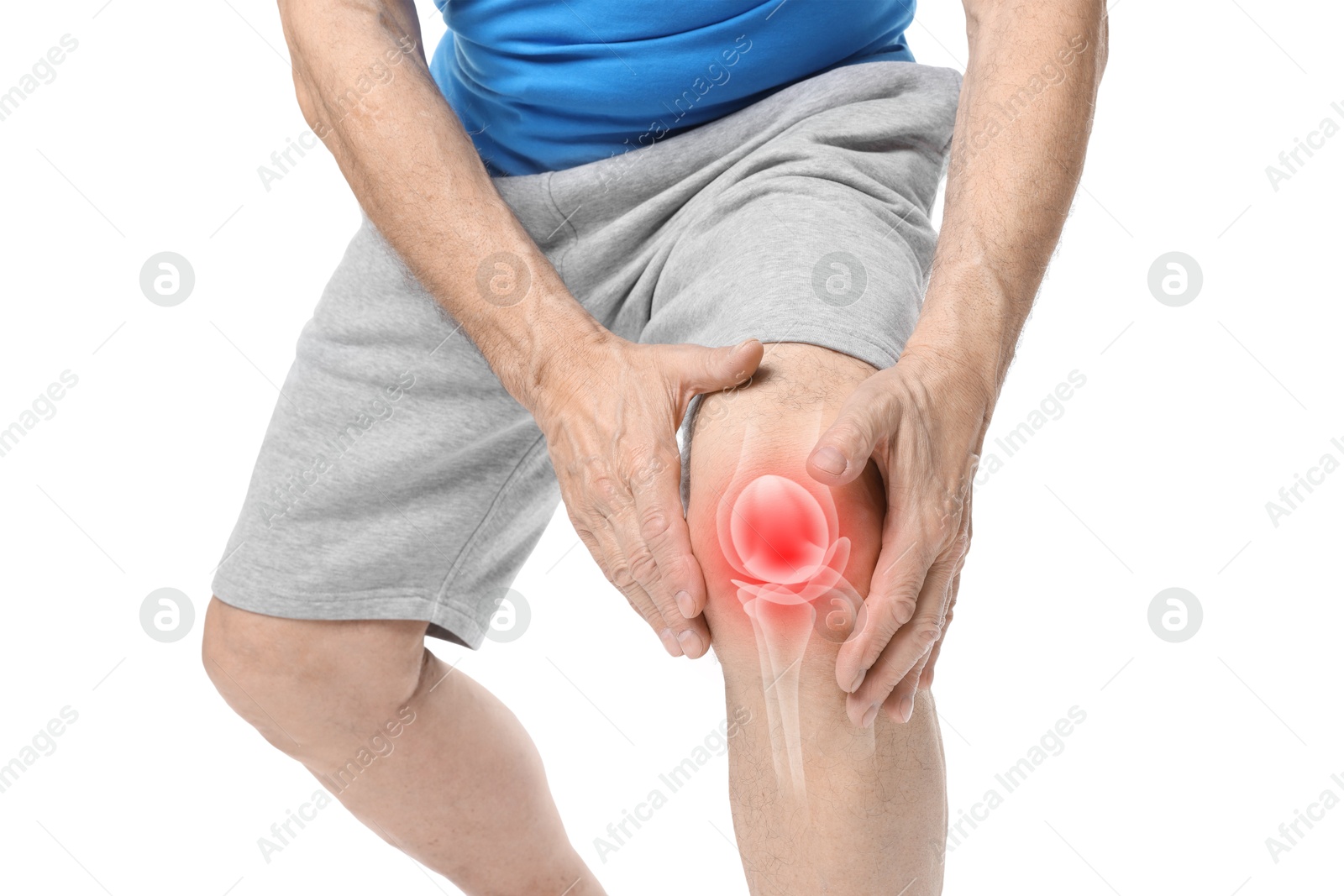 Image of Arthritis. Senior man suffering from knee pain on white background, closeup. Illustration of joint inflammation on his leg